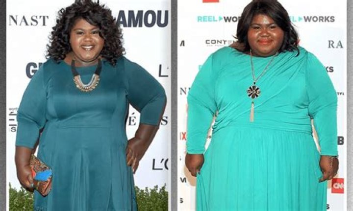 Five Celebrities Who Had Gastric Bypass Surgery