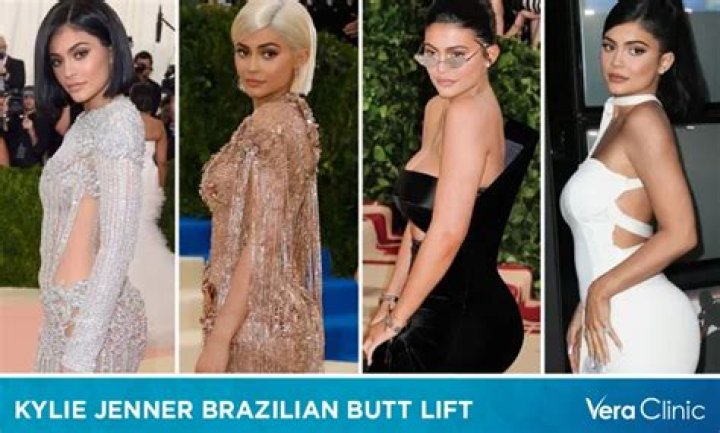Kylie Jenner Brazilian Butt Lift – More Plastic Surgery? (PHOTOS)